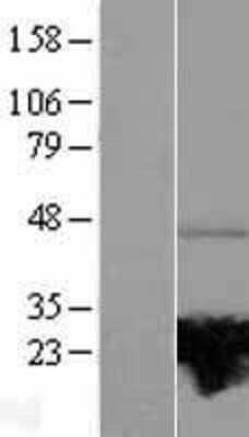 Western Blot: RAB37 Overexpression Lysate [NBL1-15067]