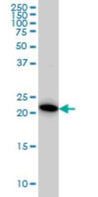 Western Blot: RAB38 Antibody (7F1) [H00023682-M02]