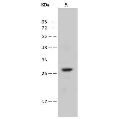 Western Blot: RAB38 Antibody [NBP2-99623]