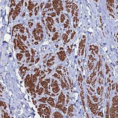 Immunohistochemistry-Paraffin: RAB39 Antibody [NBP2-13193]