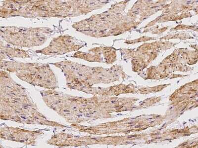 Immunohistochemistry-Paraffin: RAB39 Antibody [NBP2-99624]