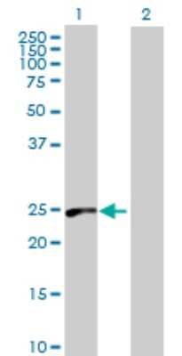 Western Blot: RAB39 Antibody [H00054734-B01P]