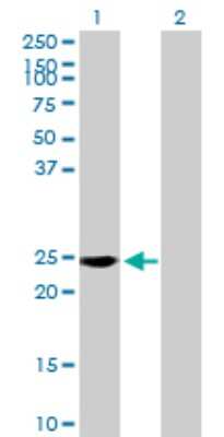 Western Blot: RAB39 Antibody [H00054734-B02P]