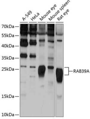 Western Blot: RAB39 AntibodyAzide and BSA Free [NBP2-93927]