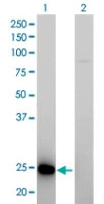 Western Blot: RAB39B Antibody (1E11) [H00116442-M01]