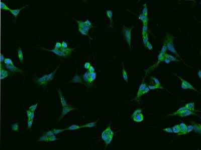 Immunocytochemistry/ Immunofluorescence: RAB39B Antibody [NBP2-97201]