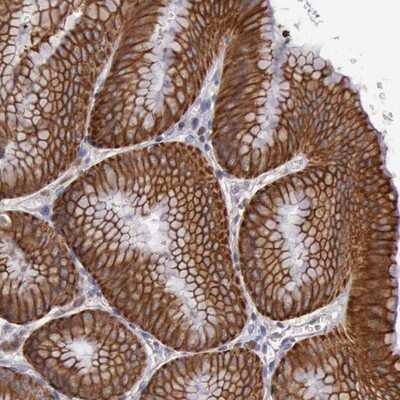 Immunohistochemistry-Paraffin: RAB39B Antibody [NBP1-85819]