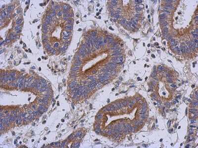 Immunohistochemistry-Paraffin: RAB39B Antibody [NBP2-20044]
