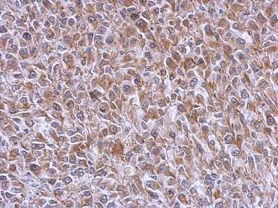 Immunohistochemistry-Paraffin: RAB39B Antibody [NBP2-20044]