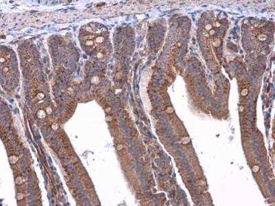 Immunohistochemistry-Paraffin: RAB39B Antibody [NBP2-20044]