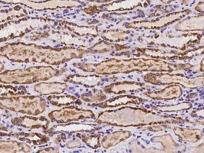 Immunohistochemistry-Paraffin: RAB39B Antibody [NBP2-97201]