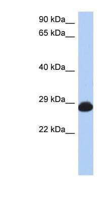 Western Blot: RAB39B Antibody [NBP1-58900]