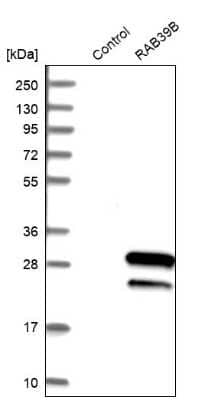 Western Blot: RAB39B Antibody [NBP1-85819]