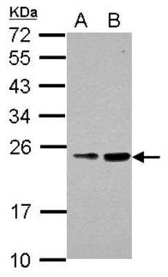 Western Blot: RAB39B Antibody [NBP2-20044]