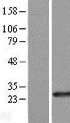 Western Blot: RAB39B Overexpression Lysate [NBL1-15070]