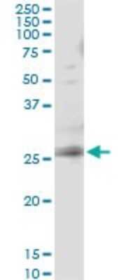 Immunoprecipitation: RAB3B Antibody (1A7) [H00005865-M02]