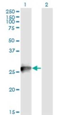 Western Blot: RAB3B Antibody (1A7) [H00005865-M02]