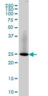 Western Blot: RAB3B Antibody (3F12) [H00005865-M01]