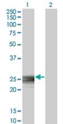 Western Blot: RAB3B Antibody (3F12) [H00005865-M01]