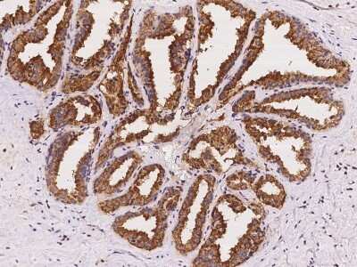 Immunohistochemistry-Paraffin: RAB3B Antibody [NBP2-97202]