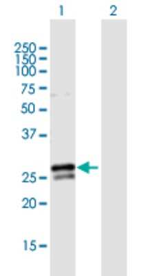 Western Blot: RAB3B Antibody [H00005865-B02P]