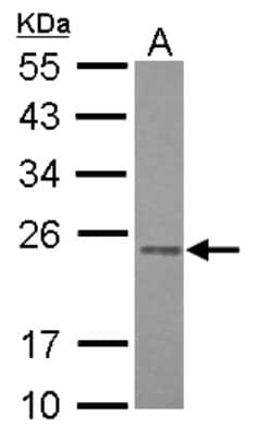 Western Blot: RAB3B Antibody [NBP2-20045]