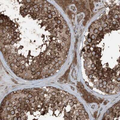 Immunohistochemistry-Paraffin: RAB3GAP1 Antibody [NBP2-38206]