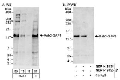 Western Blot: RAB3GAP1 Antibody [NBP1-19154]