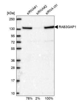 Western Blot: RAB3GAP1 Antibody [NBP2-38206]