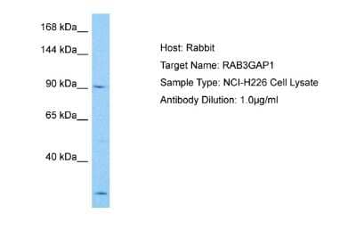 Western Blot: RAB3GAP1 Antibody [NBP2-85578]