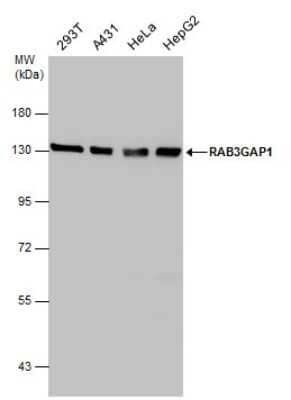 Western Blot: RAB3GAP1 Antibody [NBP3-12984]