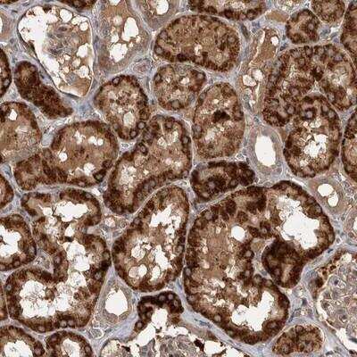 Immunohistochemistry-Paraffin: RAB3GAP2 Antibody [NBP1-84198]