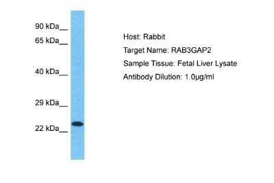 Western Blot: RAB3GAP2 Antibody [NBP2-85579]