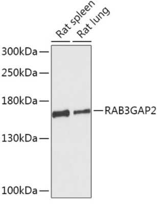 Western Blot: RAB3GAP2 AntibodyAzide and BSA Free [NBP2-93097]