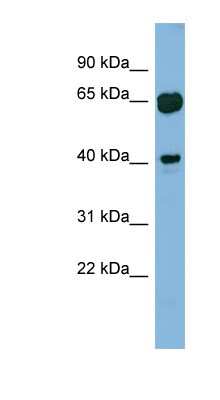 Western Blot: RAB3IL1 Antibody [NBP1-55343]