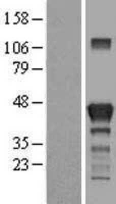 Western Blot: RAB3IL1 Overexpression Lysate [NBL1-15074]