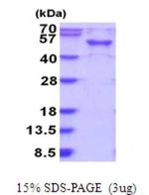 SDS-PAGE: Recombinant Human RAB3IL1 His Protein [NBP2-51916]