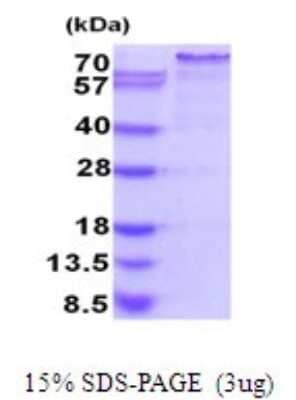 SDS-PAGE: Recombinant Human Nrf2 His Protein [NBP2-51955]