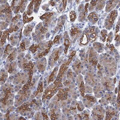Immunohistochemistry-Paraffin: RAB3IP Antibody [NBP1-92309]