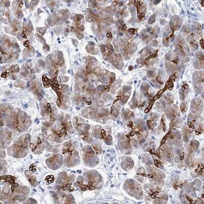 Immunohistochemistry-Paraffin: RAB3IP Antibody [NBP1-92309]