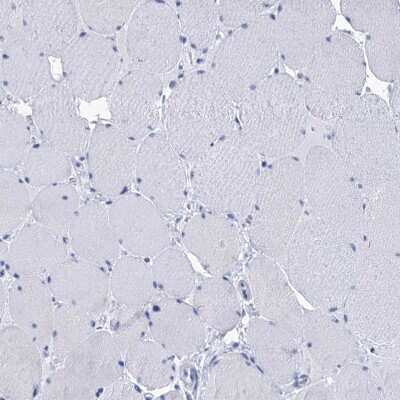 Immunohistochemistry-Paraffin: RAB3IP Antibody [NBP1-92309]