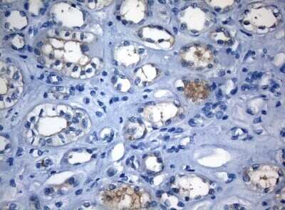 Immunohistochemistry: RAB3IP Antibody (OTI5F2) - Azide and BSA Free [NBP2-73775]