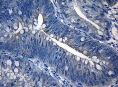 Immunohistochemistry-Paraffin: RAB3IP Antibody (OTI5F2) [NBP2-45500]