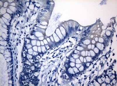 Immunohistochemistry-Paraffin: RAB3IP Antibody (OTI5F2) [NBP2-45500]