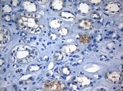Immunohistochemistry-Paraffin: RAB3IP Antibody (OTI5F2) [NBP2-45500]