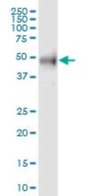 Western Blot: RAB3IP Antibody [H00117177-B01P]