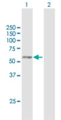 Western Blot: RAB3IP Antibody [H00117177-B01P]