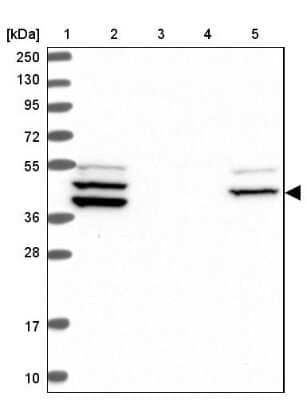 Western Blot: RAB3IP Antibody [NBP1-92309]