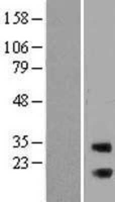 Western Blot: RAB3IP Overexpression Lysate [NBL1-15075]