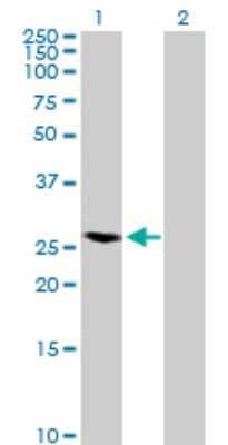 Western Blot: RAB40A Antibody [H00142684-B01P]